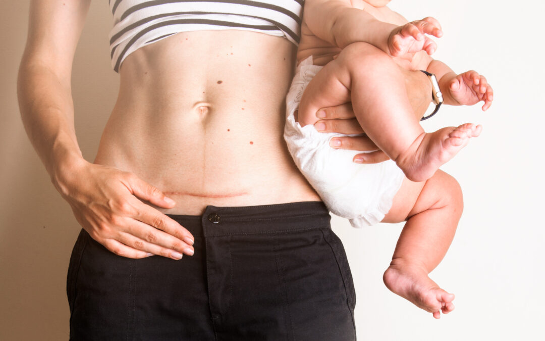 Postpartum Body Image: My Naked Truth
